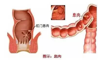 北京肛肠（北京看肠道最好的医院排名）,北京肛肠（北京看肠道最好的医院排名）,第1张