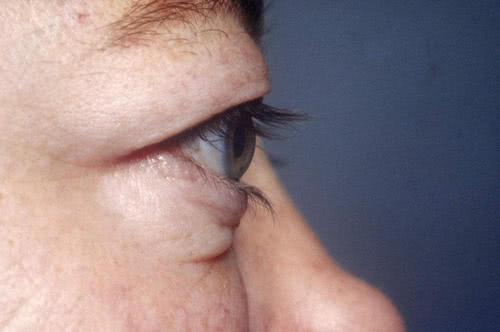 眼睛疾病（眼睛疾病一共有多少种）,眼睛疾病（眼睛疾病一共有多少种）,第2张